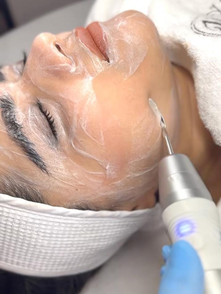 Deep Cleansing with Chisel Tool