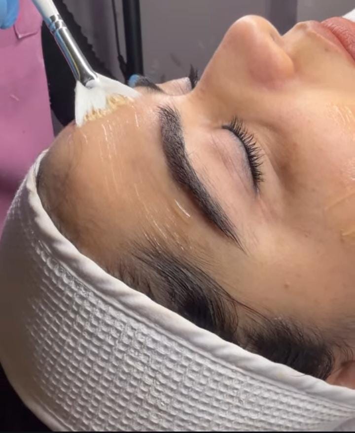 Gel Application for Skin Preparation