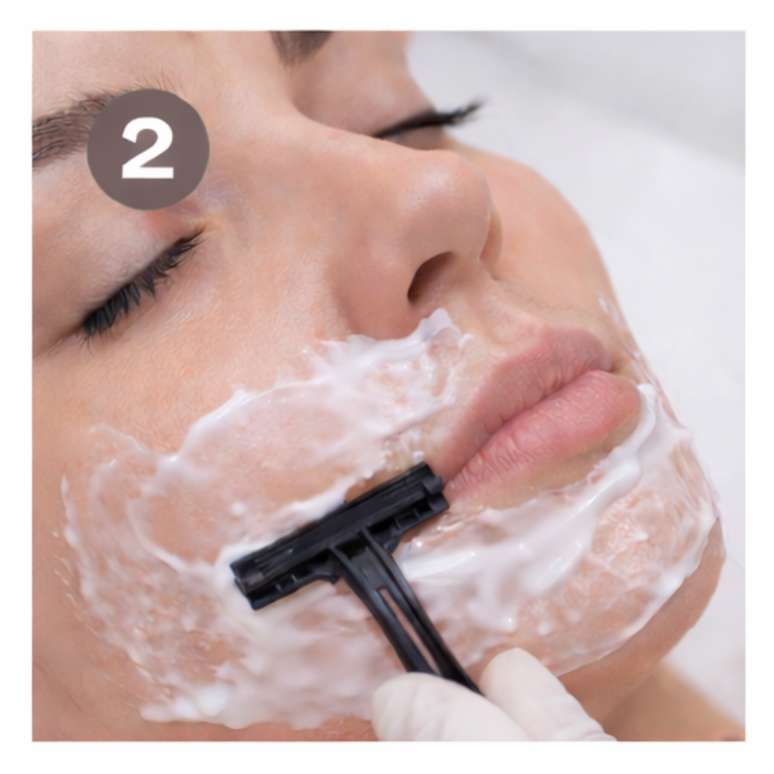 Skin Preparation